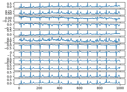 ECG-Lense: Cardiac ECG Classification (IEEE Published)