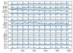 ECG-Lense: Cardiac ECG Classification (IEEE Published)